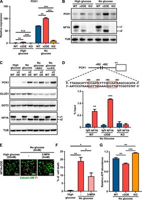 NFYA promotes the anti-tumor effects of gluconeogenesis in hepatocellular carcinoma through the regulation of PCK1 expression